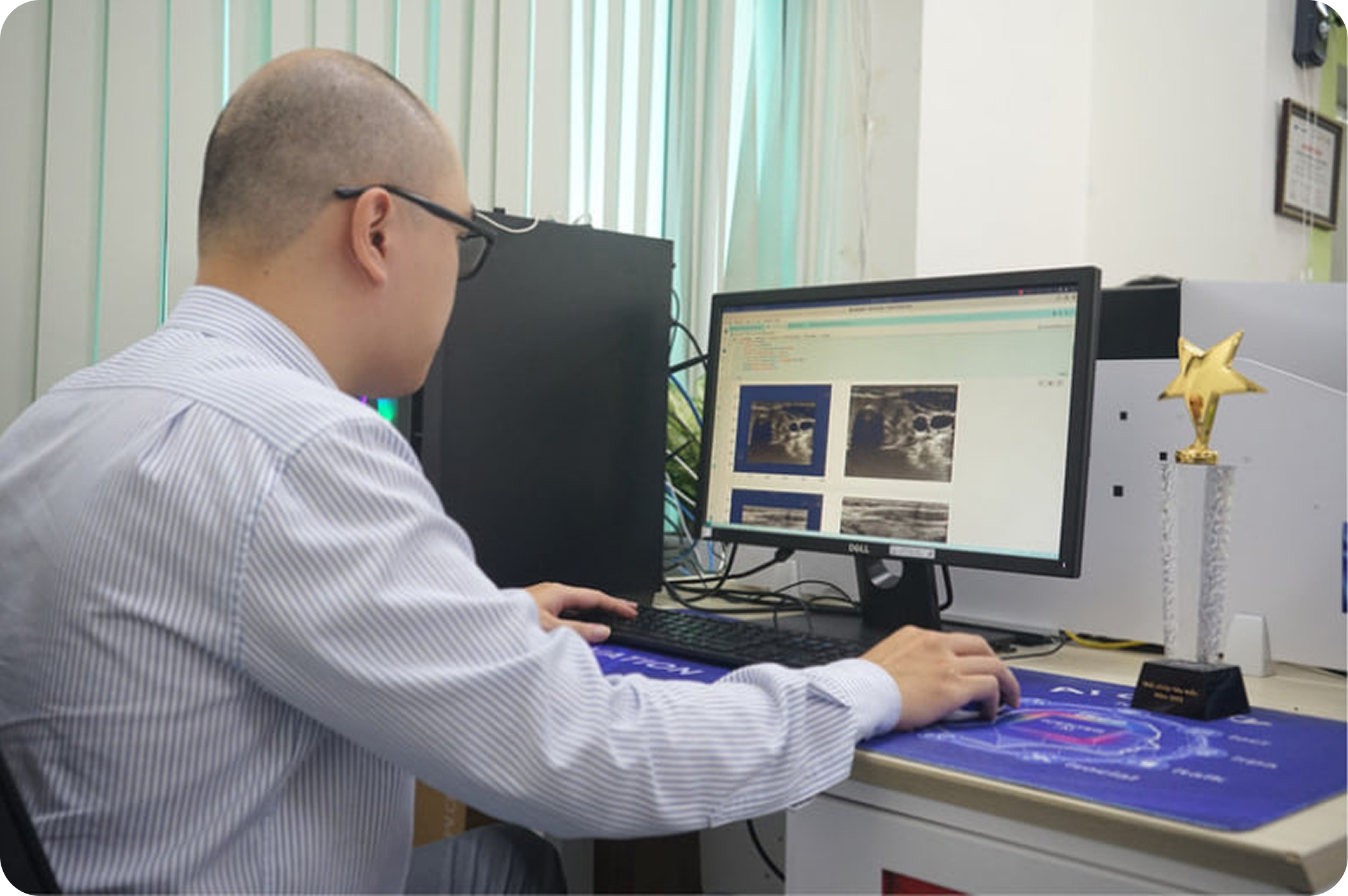 ứng dụng VNPT SmartVision chẩn đoán ung thư tuyến giáp